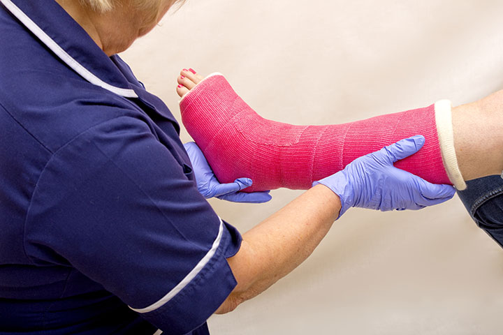 A nurse assesses a pink cast on a leg. Learn more about time limits to claim personal injury.
